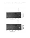 ULTRASOUND APPARATUS AND ULTRASOUND METHOD FOR BEAMFORMING WITH A PLANE     WAVE TRANSMISSION diagram and image