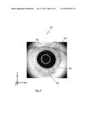 APPARATUS FOR OPTICAL COHERENCE TOMOGRAPHY OF AN EYE AND METHOD FOR     OPTICAL COHERENCE TOMOGRAPHY OF AN EYE diagram and image