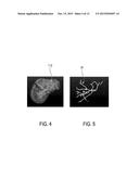 ULTRASOUND IMAGING SYSTEM AND METHOD FOR IMAGE GUIDANCE PROCEDURE diagram and image