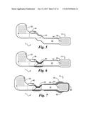 Method of Manufacturing a Flexible Circuit Electrode Array diagram and image