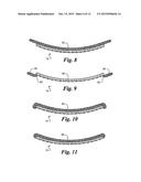 Method of Manufacturing a Flexible Circuit Electrode Array diagram and image