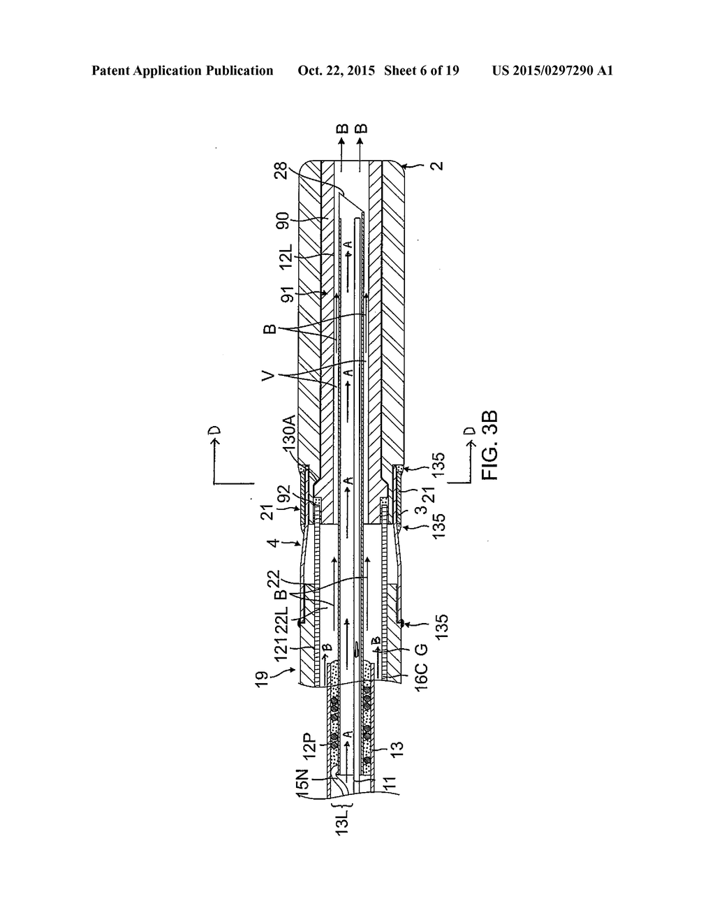 ABLATION CATHETER WITH DEDICATED FLUID PATHS AND NEEDLE CENTERING INSERT - diagram, schematic, and image 07