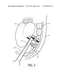 PRESSURE SENSING ELECTRIC TOOTHBRUSH diagram and image