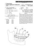 ARTICLE AND METHOD FOR CONTROLLING ORAL-ORIGINATED SYSTEMIC DISEASE diagram and image