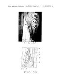 ARTICLE AND METHOD FOR CONTROLLING ORAL-ORIGINATED SYSTEMIC DISEASE diagram and image