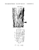 ARTICLE AND METHOD FOR CONTROLLING ORAL-ORIGINATED SYSTEMIC DISEASE diagram and image