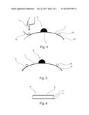 AN ADAPTABLE OSTOMY BASE PLATE diagram and image