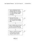 APPARATUS AND METHOD FOR TREATING THE INSIDE OF AN EYE diagram and image