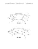 SYSTEM AND METHOD FOR RESECTING CORNEAL TISSUE diagram and image