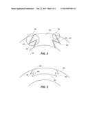 SYSTEM AND METHOD FOR RESECTING CORNEAL TISSUE diagram and image