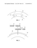 SYSTEM AND METHOD FOR RESECTING CORNEAL TISSUE diagram and image