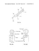 CATARACT REMOVAL DEVICE AND INTEGRATED TIP diagram and image