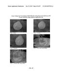 FOAMABLE FORMULATION diagram and image