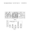 METHODS OF TREATING PULMONARY FIBROSIS diagram and image