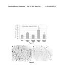 METHODS OF TREATING PULMONARY FIBROSIS diagram and image