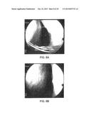 CONTROLLED RELEASE TOPICAL TESTOSTERONE FORMULATIONS AND METHODS diagram and image