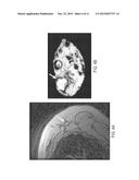 MACROPHAGE-ENHANCED MRI (MEMRI) IN A SINGLE IMAGING SESSION diagram and image