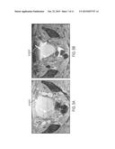 MACROPHAGE-ENHANCED MRI (MEMRI) IN A SINGLE IMAGING SESSION diagram and image