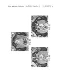 MACROPHAGE-ENHANCED MRI (MEMRI) IN A SINGLE IMAGING SESSION diagram and image