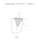 DEMINERALIZED CANCELLOUS STRIP DBM GRAFT diagram and image