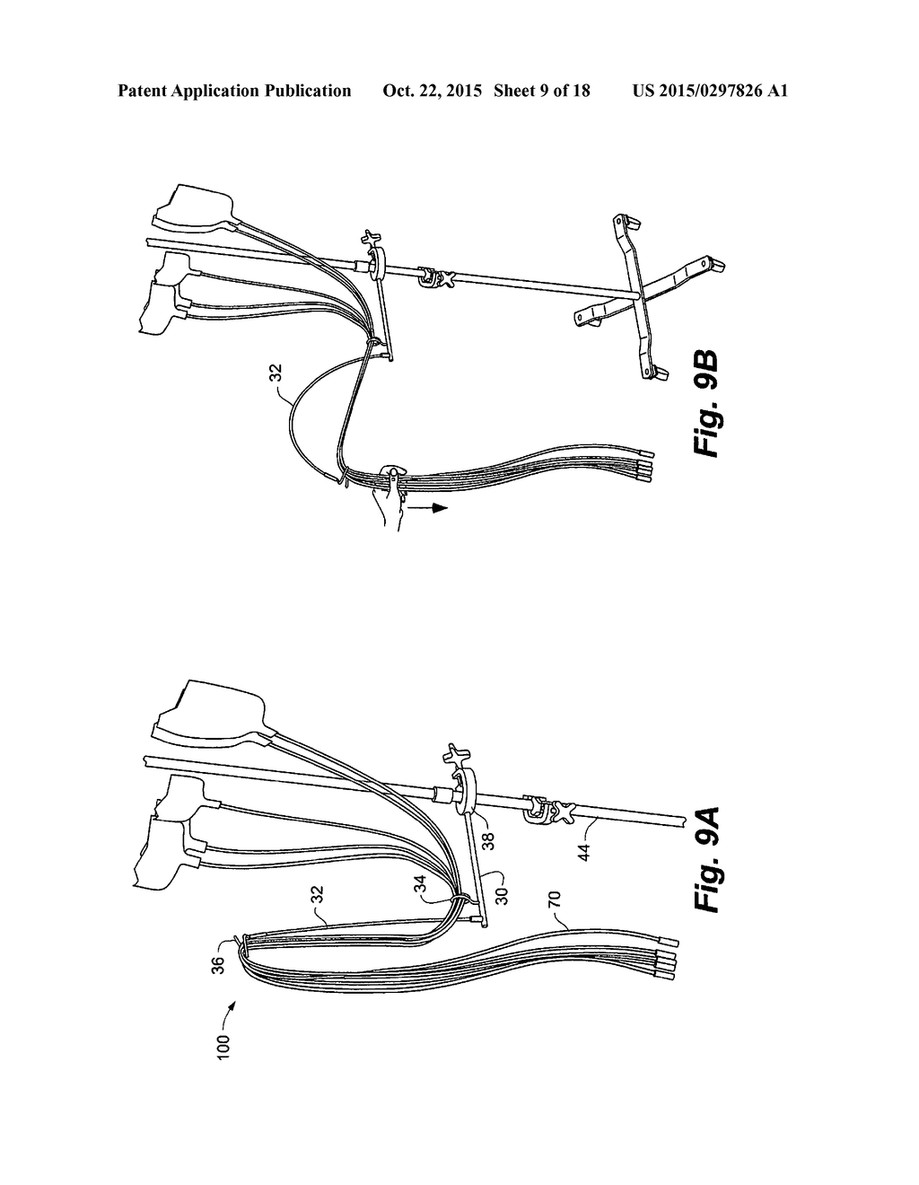 INTRAVENOUS LINE LIFTER DEVICES, SYSTEMS AND METHODS - diagram, schematic, and image 10