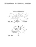 CATHETER SECUREMENT DEVICES diagram and image