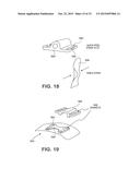 CATHETER SECUREMENT DEVICES diagram and image