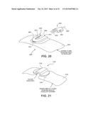 CATHETER SECUREMENT DEVICES diagram and image