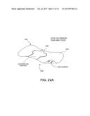 CATHETER SECUREMENT DEVICES diagram and image