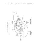 CATHETER SECUREMENT DEVICES diagram and image