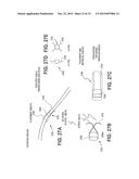 CATHETER SECUREMENT DEVICES diagram and image