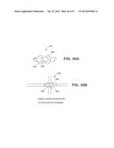 CATHETER SECUREMENT DEVICES diagram and image