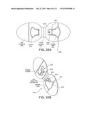 CATHETER SECUREMENT DEVICES diagram and image