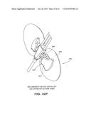 CATHETER SECUREMENT DEVICES diagram and image