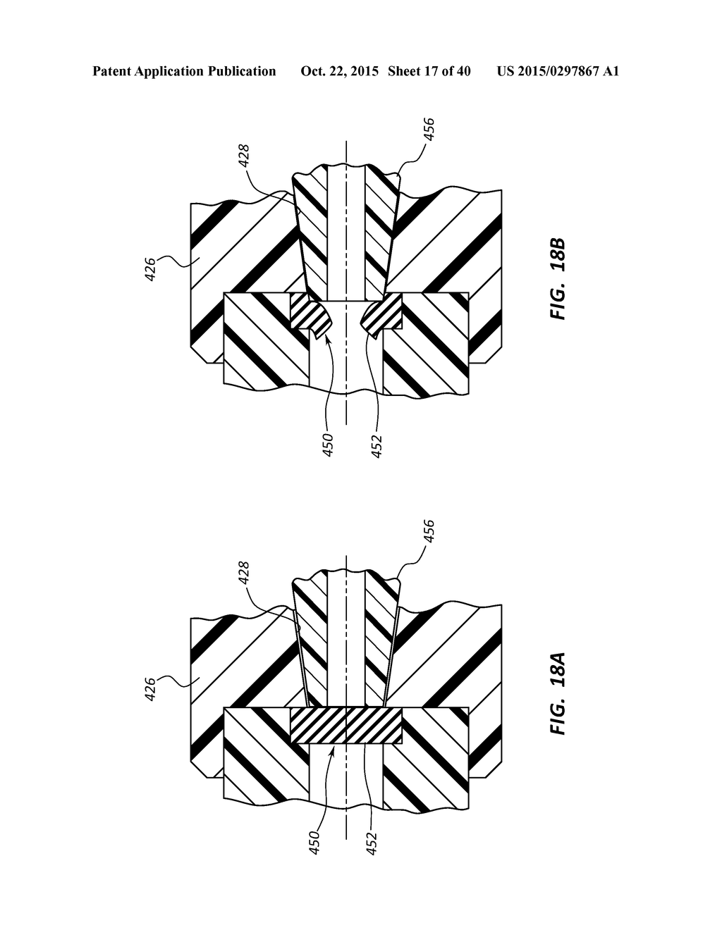 Antimicrobial/Haemostatic Interface Pad for Placement Between     Percutaneously Placed Medical Device And Patient Skin - diagram, schematic, and image 18