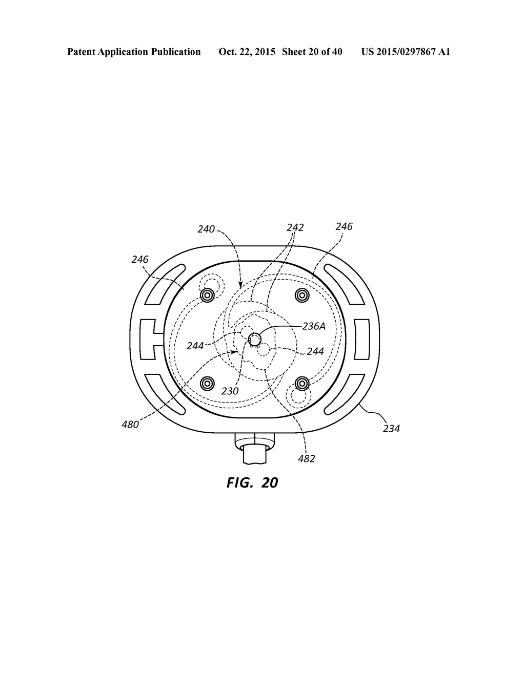 Antimicrobial/Haemostatic Interface Pad for Placement Between     Percutaneously Placed Medical Device And Patient Skin - diagram, schematic, and image 21