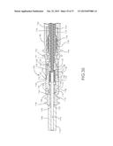 CARDIAC ELECTRICAL LEAD diagram and image