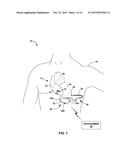 SYSTEMS AND METHODS FOR LEADLESS PACING AND SHOCK THERAPY diagram and image