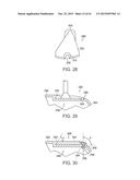 GOLF CLUB HAVING REMOVEABLE WEIGHT diagram and image