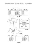 METHOD AND SYSTEM FOR MARKING A SURFACE BY LASER TREATMENT diagram and image