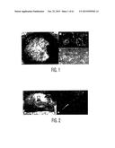 Adult Stem Cells/Progenitor Cells and Stem Cell Proteins for Treatment of     Eye Injuries and Diseases diagram and image