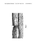 Adult Stem Cells/Progenitor Cells and Stem Cell Proteins for Treatment of     Eye Injuries and Diseases diagram and image