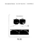 Adult Stem Cells/Progenitor Cells and Stem Cell Proteins for Treatment of     Eye Injuries and Diseases diagram and image