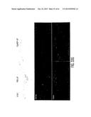 Adult Stem Cells/Progenitor Cells and Stem Cell Proteins for Treatment of     Eye Injuries and Diseases diagram and image