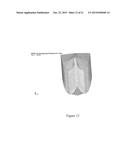 HIGH PRESSURE ENHANCED STRUCTURE TECHNOLOGY diagram and image