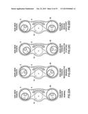 TENSIONER diagram and image