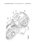 TENSIONER diagram and image