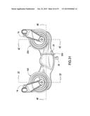 TENSIONER diagram and image