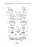 TENSIONER diagram and image