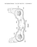 TENSIONER diagram and image